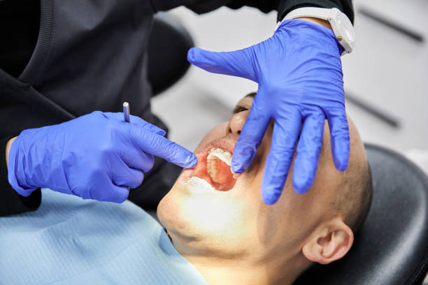 Best Emergency Dentist for Lost Fillings or Crowns in Apple Valley, UT